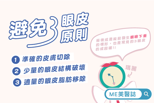 三眼皮怎麼辦 三眼皮怎麼辦
